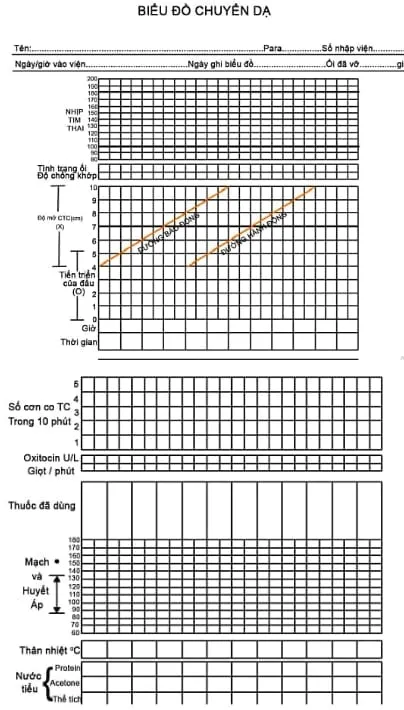 Biểu đồ chuyển dạ