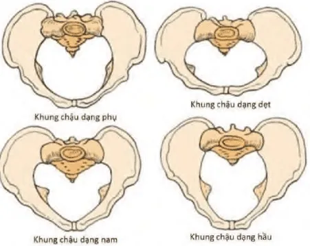 Các dạng khung chậu