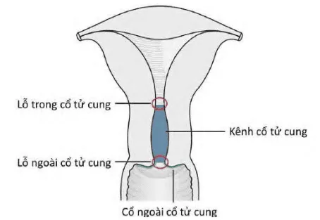 Các điểm mốc nhận diện quan trọng trong bệnh học cổ tử cung
