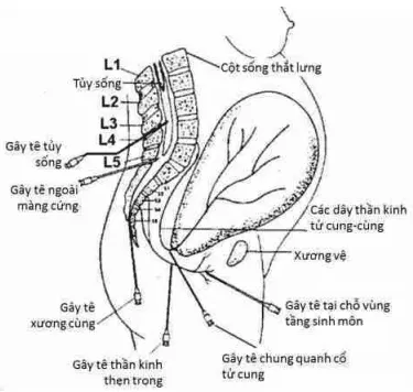 Các phương pháp có thể dùng để giảm đau trong chuyển dạ