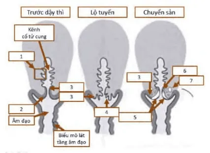 Các ranh giới lát trụ nguyên thủy và mới