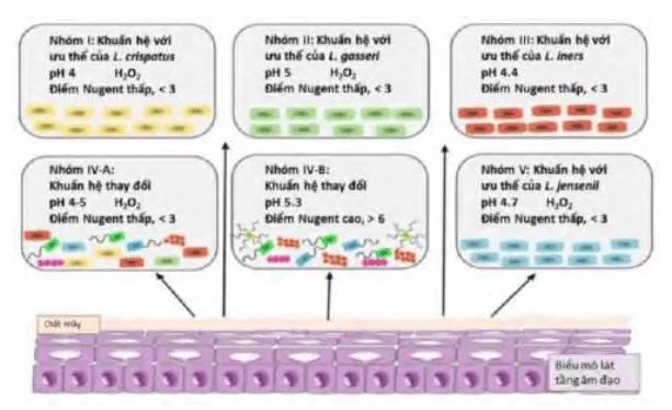 Các kiểu trạng thái khuẩn hệ âm đạo