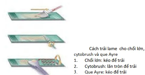 Cách trải lam