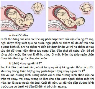 Đẻ thường ngôi chỏm e-f