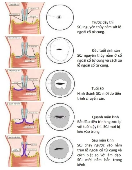 Dịch chuyển SCJ nguyên thủy và SCJ mới