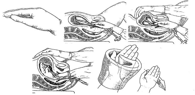 Kỹ thuật bóc rau nhân tạo