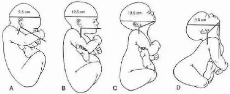 Phân loại ngôi đầu