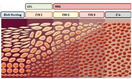 Phân chia cổ điển