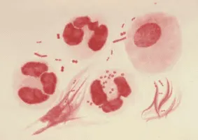 N. gonorrhoeae