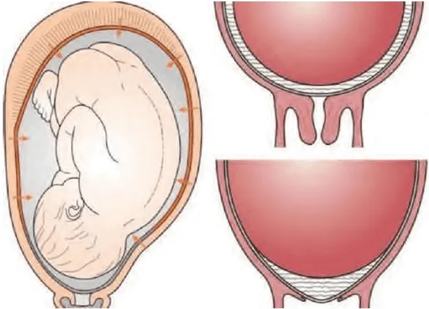 Thành lập đầu ối