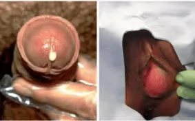 Tiết dịch cơ quan sinh dục