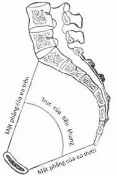 Tiểu khung trên thiết đồ đứng dọc