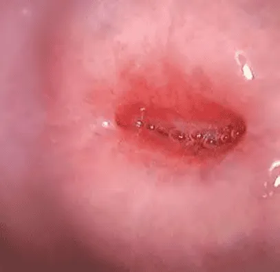 Vùng chuyển sản